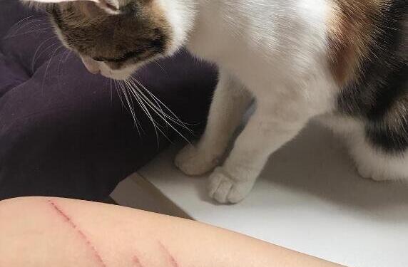 被猫抓了没打针有事吗_猫抓了只打疫苗不打血清_打针的猫抓了有事吗